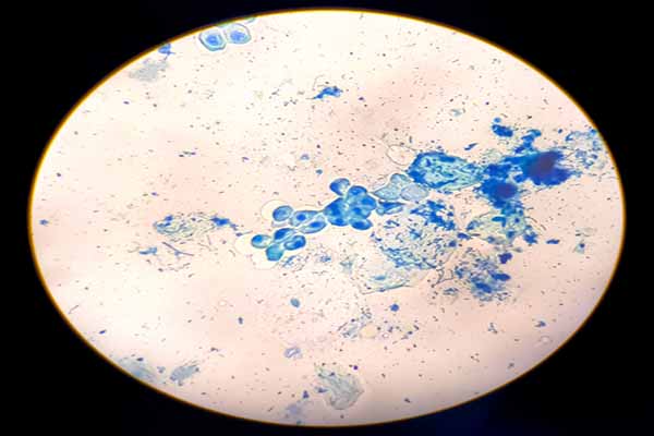Module Medical Microbiology HSOB5006
