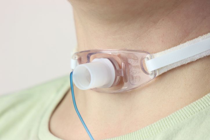 Tracheostomy Workshop  cover image