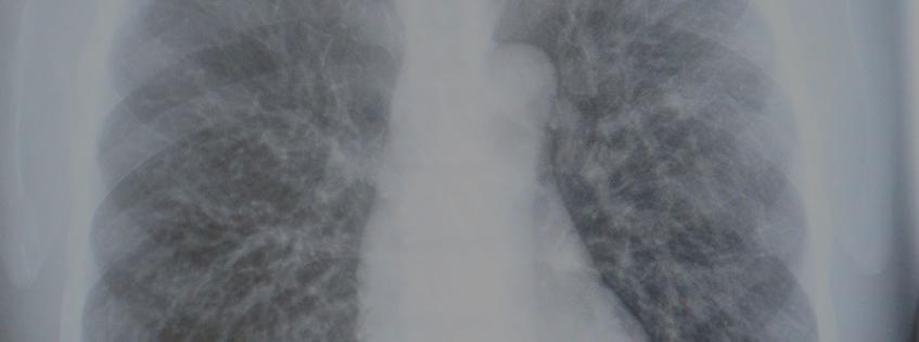 Medical Imaging: Magnetic Resonance Imaging cover image